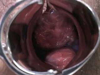 妊娠中の日本人女性が検査され、医師のlollicockを吸引されます