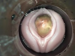 ovulasi melekit oleh merangkap cam lelaki